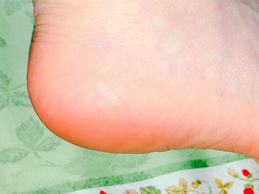 5セカンズシャイン使用後の写真